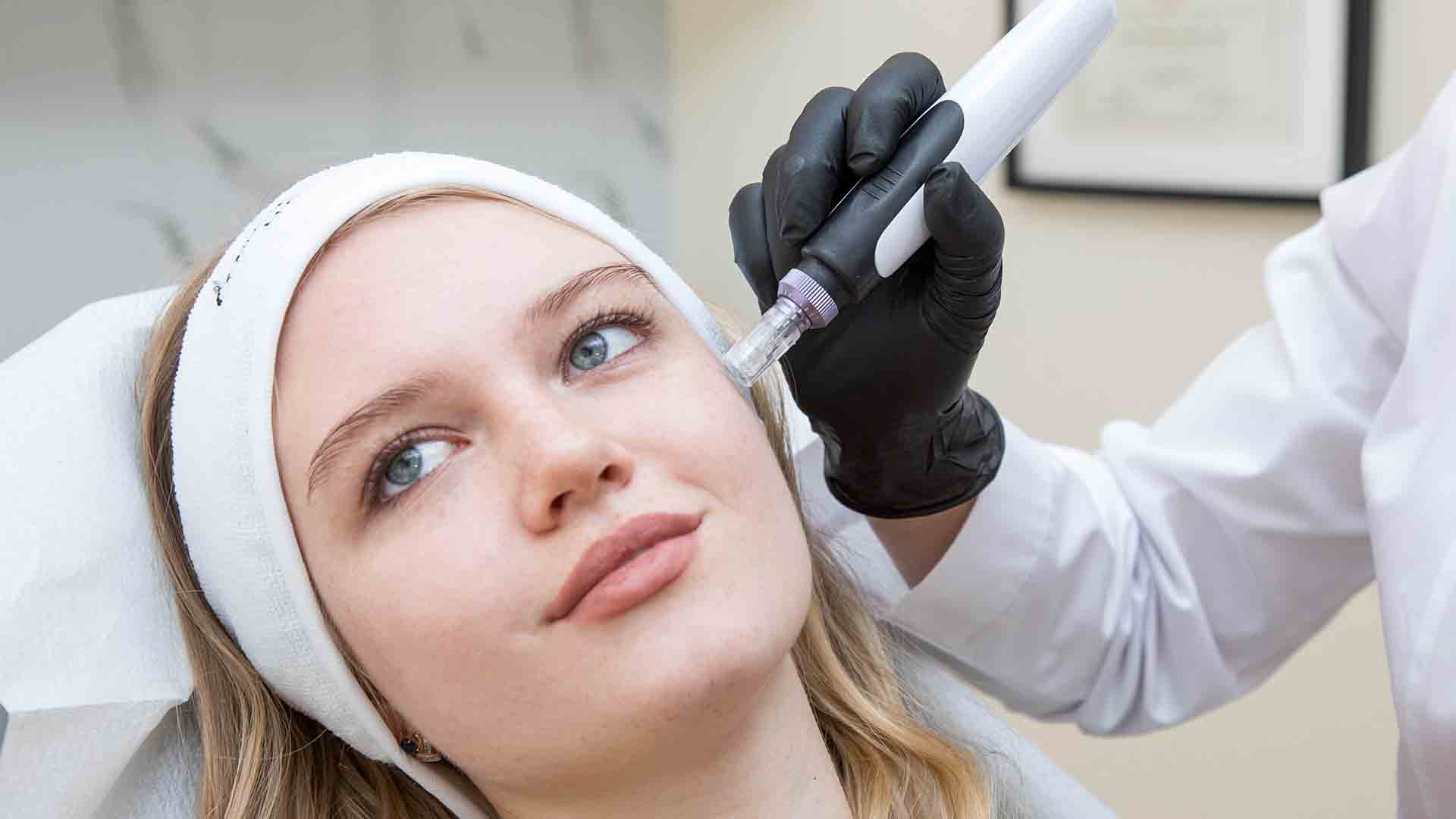 Dermapen-hero-1 Dermapen-hero-1