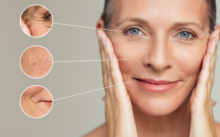 ساختار پوست و علت پیری و چروک شدن پوست